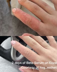 Neogenesis Beta-Glucan Serum